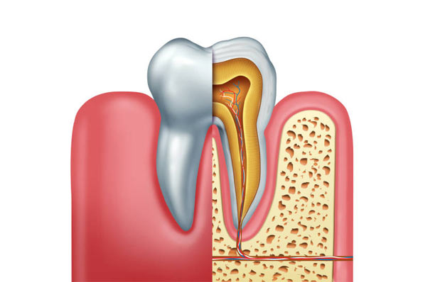 tooth discoloration and stains